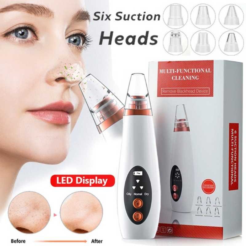 Original blackhead Remover - Image 2